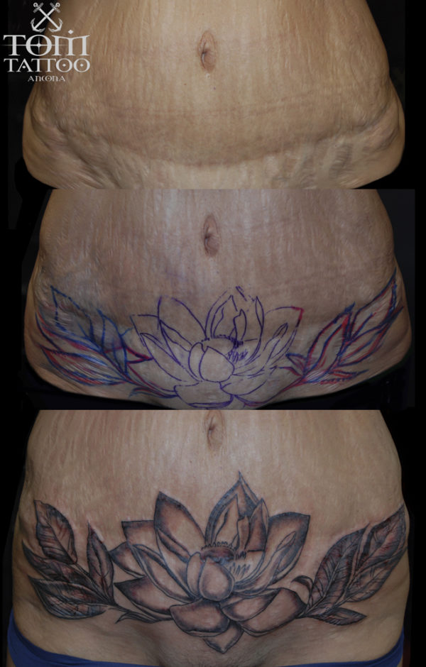Copertura di cicatrice sul ventre con un fiore di loto in bianco e nero
