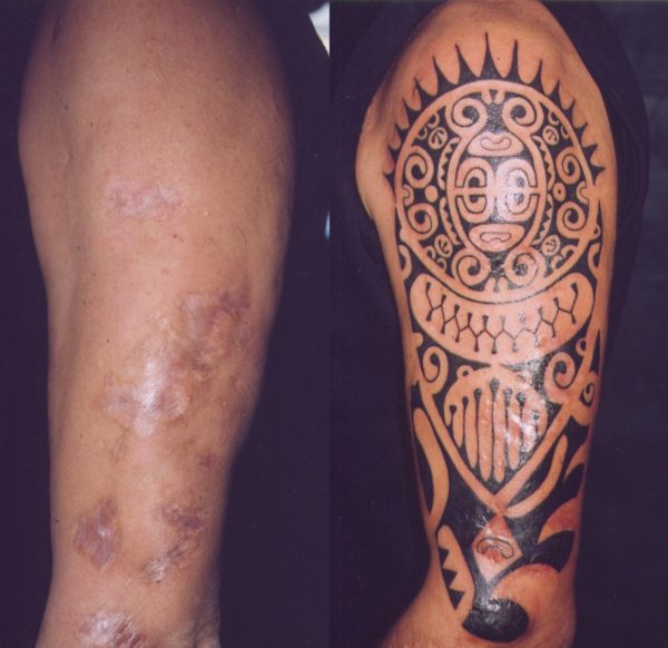 Copertura di bruciatura con un tatuaggio polinesiano