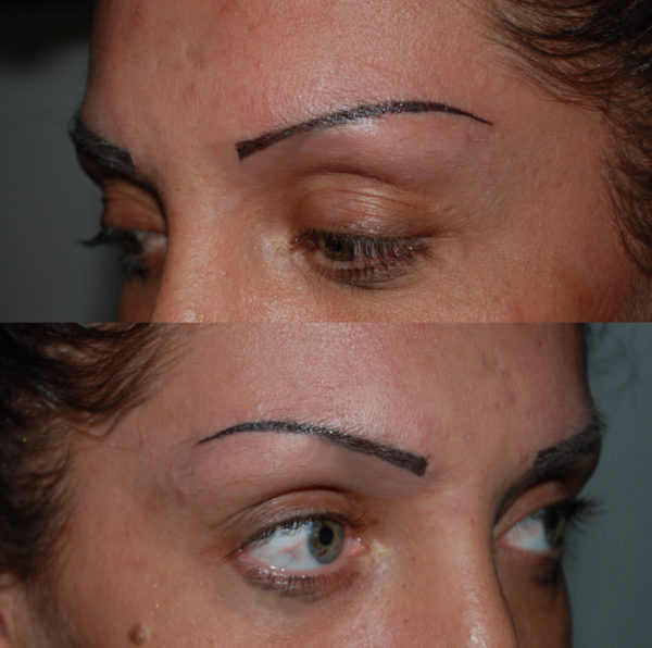 Trucco estetico